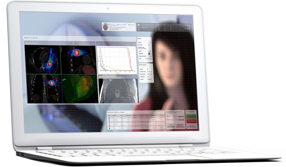 Elekta Software Vision